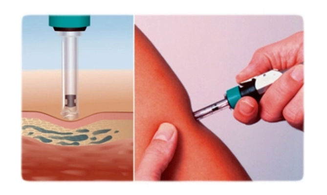 注射器密合性正壓負(fù)壓測試儀對器身密封性質(zhì)量檢測的重要性